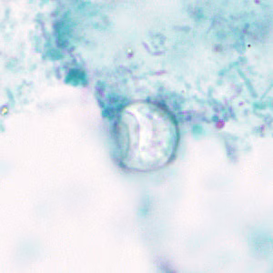 Cyclospora_trichrome_HB1.jpg