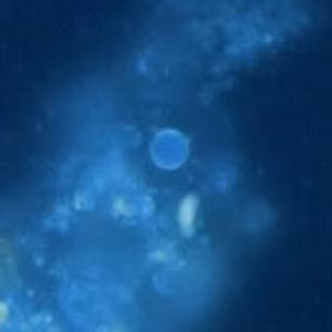 Cyclospora_UV_Henry1.jpg