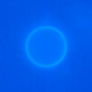Cyclospora_UV_Mike1.jpg