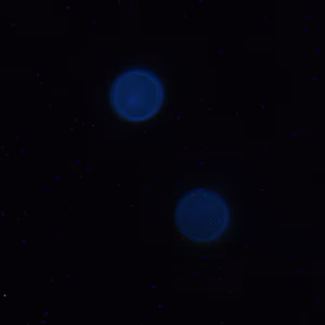 Cyclospora_UV_Mike3.jpg