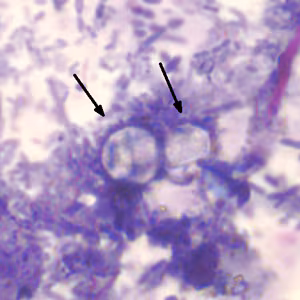Cyclospora_AF_AZ1.jpg