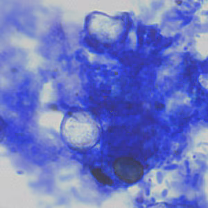 Cyclospora_AF_AZ2.jpg