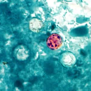 Cyclospora_AF_Henry1.jpg