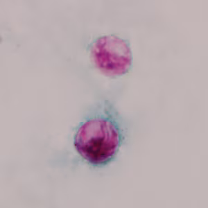 Cyclospora_AF_Henry3.jpg