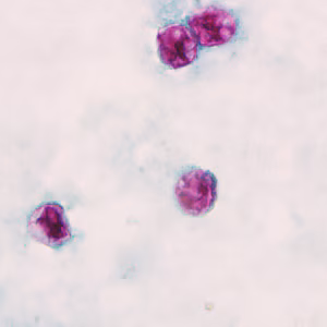 Cyclospora_AF_Henry4.jpg