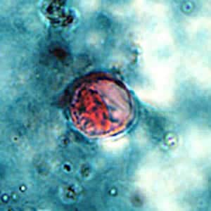 Cyclospora_SAF_Henry1.jpg