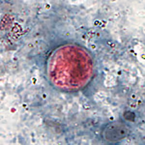 Cyclospora_SAF_Henry2.jpg