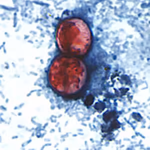 Cyclospora_SAF_Henry5.jpg