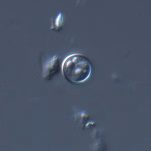 Cyclospora_DIC_Mike1.jpg