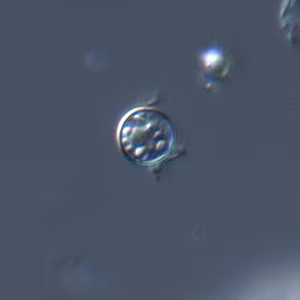 Cyclospora_DIC_Mike2.jpg
