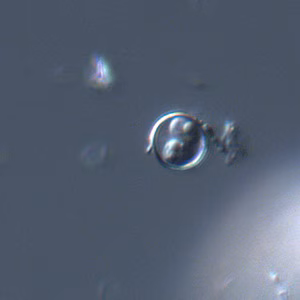 Cyclospora_DIC_Mike3.jpg