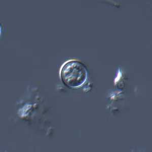 Cyclospora_DIC_Mike5.jpg