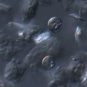 Cyclospora_DIC_Mike6.jpg
