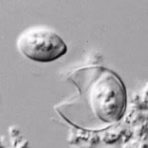 Cyclospora_DIC_rupture.jpg