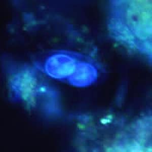 C_belli_oocyst_UV_IN.jpg