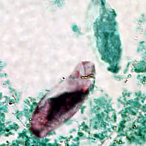 C_belli_oocyst_acidfast.jpg