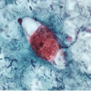 C_belli_oocyst_safranin.jpg