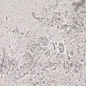 C_belli_oocyst_wtmt2_40x.jpg