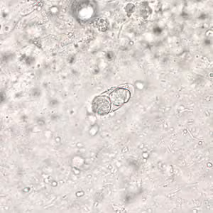 C_belli_oocyst_wtmt_40x.jpg