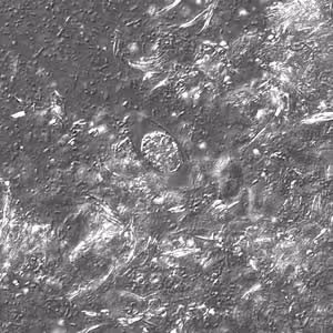 C_belli_oocyst_wtmt_DIC2_40x.jpg