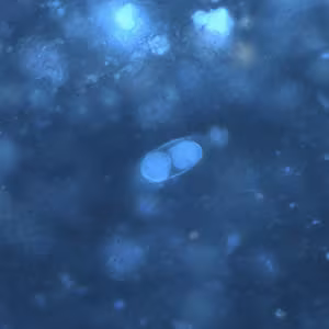 C_belli_oocyst_wtmt_uv_40x.jpg