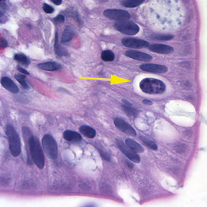 Cystoisospora_HE_1.jpg