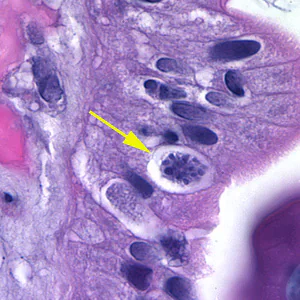 Cystoisospora_HnE_3.jpg
