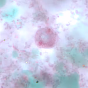 Figure E