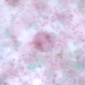 Figure D