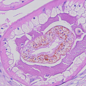 Figure D