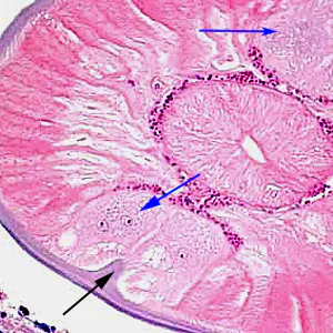 Dirofilaria_DerksA.jpg