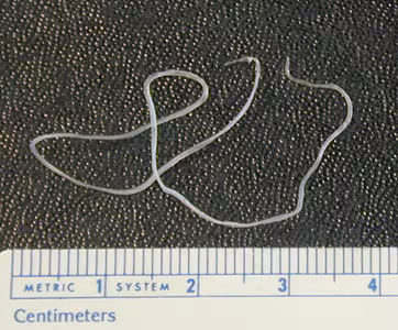 Dirofilaria_eye_BAM1.jpg