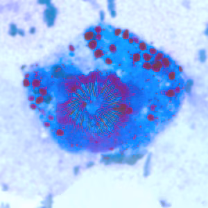 Figure B