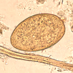 F_buski_egg_wtmt_BAM1.jpg