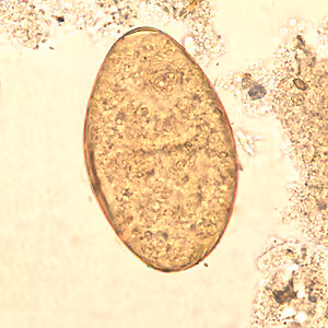 F_buski_egg_wtmt_BAM2.jpg