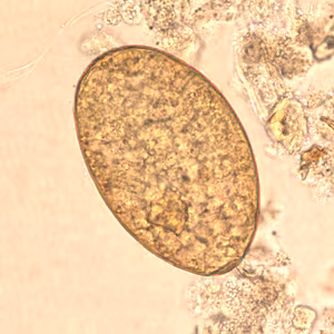 F_buski_egg_wtmt_BAM3.jpg