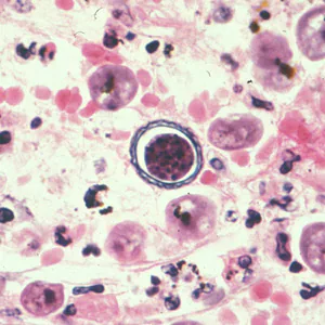 Acanthamoeba_HE_Vish3.jpg