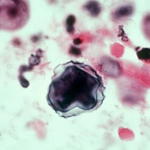 Acanthamoeba_HE_Vish4.jpg