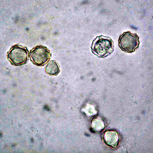 Acanthamoeba_cysts_culture_Vish2.jpg