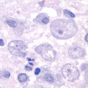 Acanthamoeba.jpg