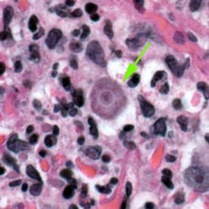 Acanthamoeba_HE_Vish1_1000x.jpg