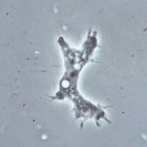 Acanthamoeba_troph_culture_Vish1.jpg