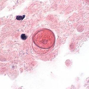 B_mandrillaris_UKY1.jpg