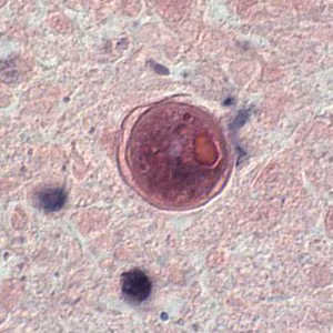 B_mandrillaris_UKY2.jpg