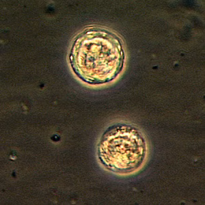 Balamuthia_cyst_Vish1.jpg