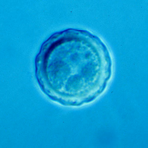 Balamuthia_cyst_Vish3.jpg
