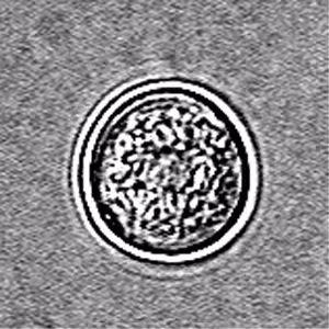N_fowleri_cyst_Vish1.jpg
