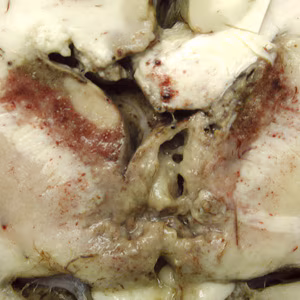 Brain_pathology_Cook1.jpg