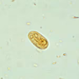 Giardia_cyst_wtmt.jpg