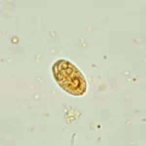 Giardia_cyst_wtmt2.jpg